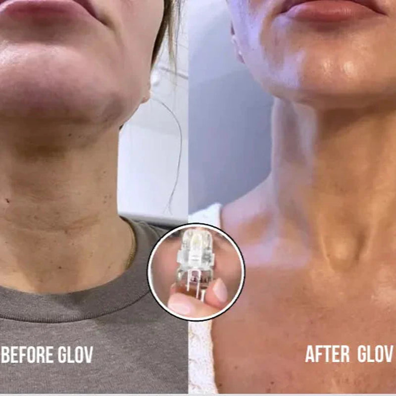 Glov Micro Infusion System